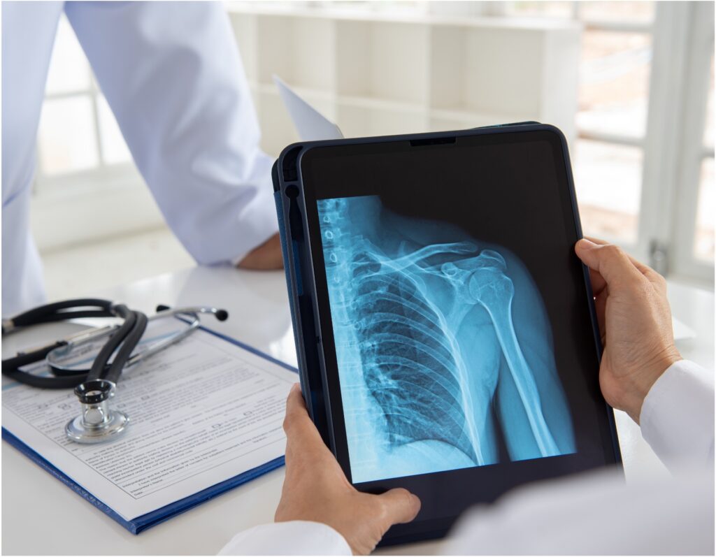 Hands holding a tablet with a xray image