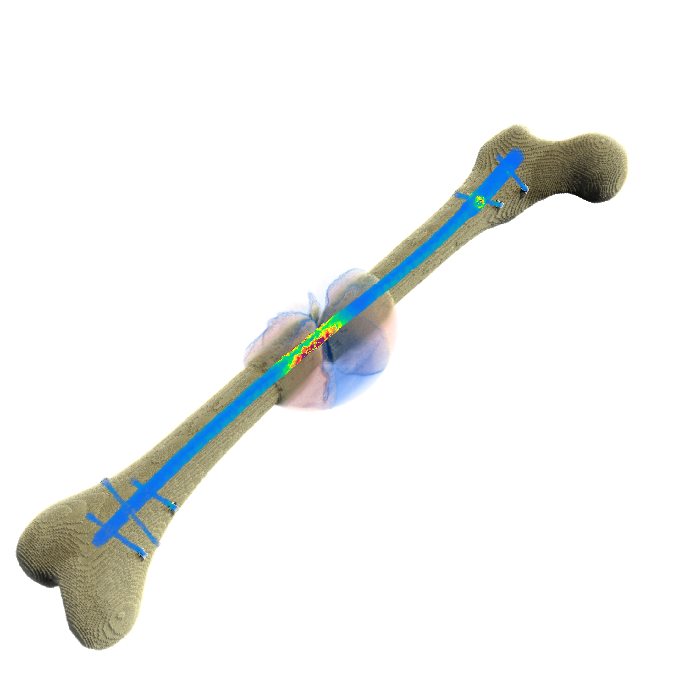 app-density+implant-stress-v4-iter84-tilted1-cmap2